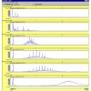 6 Channel Chromatogram